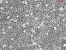 Human Corneal Epithelial Cells, Passage 1