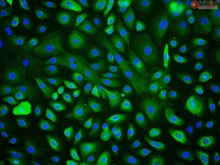 Human Corneal Epithelial Cells, Passage 1