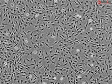 Human Keratocytes