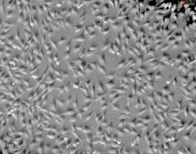 Human Keratocytes