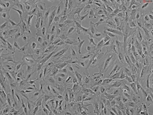 Human Lens Epithelial Cells-adult, Passage 1