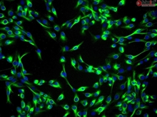 Human Lens Epithelial Cells-adult, Passage 1