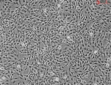 Human Iris Pigment Epithelial Cells, Passage 1