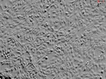 Human Iris Pigment Epithelial Cells, Passage 1