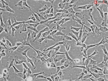 Human Conjunctival Fibroblasts