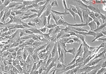 Human Non-Pigmented Ciliary Epithelial Cells, Passage 1