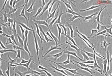 Human Trabecular Meshwork Cells, Passage 1