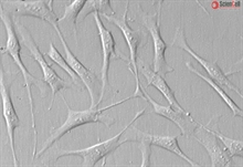 Human Trabecular Meshwork Cells, Passage 1