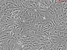 Human Ocular Choroid Fibroblasts