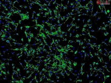 Human Ocular Choroid Fibroblasts