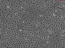 Human Myometrial Microvascular Endothelial Cells, Passage 1