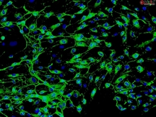 Human Myometrial Microvascular Endothelial Cells, Passage 1