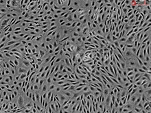 Human Endometrial Microvascular Endothelial Cells, Passage 1