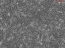 Human Myometrial Smooth Muscle Cells, Passage 1