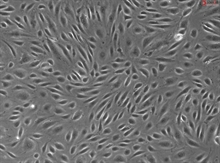 Human Placental Vascular Endothelial Cells, Passage 1