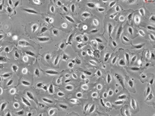 Human Amniotic Epithelial Cells, Passage 1