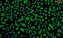 Human Amniotic Epithelial Cells, Passage 1