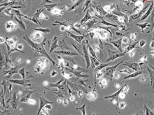 Human Villous Trophoblasts