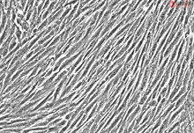 Human Villous Mesenchymal Fibroblasts