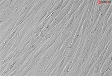 Human Villous Mesenchymal Fibroblasts