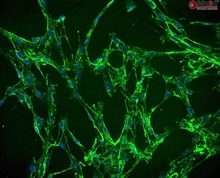 Human Villous Mesenchymal Fibroblasts