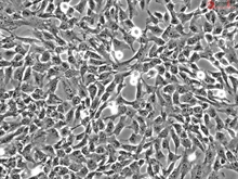 Human Amniotic Mesenchymal Stromal Cells, Passage 1