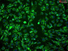 Human Amniotic Mesenchymal Stromal Cells, Passage 1