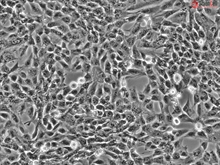 Human Chorionic Mesenchymal Stromal Cells, Passage 1