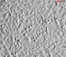 Human Chorionic Mesenchymal Stromal Cells, Passage 1