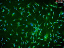 Human Chorionic Mesenchymal Stromal Cells, Passage 1