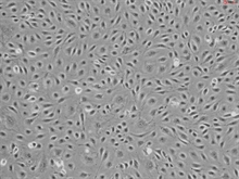 Human Ovarian Microvascular Endothelial Cells, Passage 1