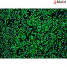 Human Ovarian Microvascular Endothelial Cells, Passage 1