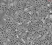 Human Ovarian Surface Epithelial Cells, Passage 1