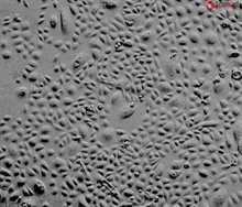 Human Ovarian Surface Epithelial Cells, Passage 1