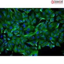 Human Ovarian Surface Epithelial Cells, Passage 1