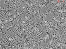 Human Ovarian Fibroblasts