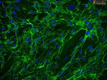 Human Ovarian Fibroblasts