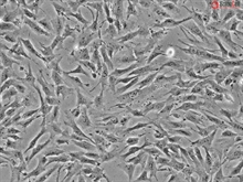 Human Bone Marrow-derived Mesenchymal Stem Cells, Passage 1