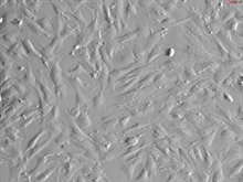 Human Bone Marrow-derived Mesenchymal Stem Cells, Passage 1