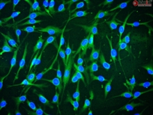 Human Bone Marrow-derived Mesenchymal Stem Cells, Passage 1