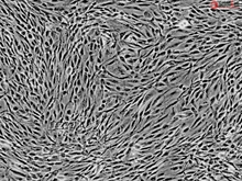 Human Adipose-derived Mesenchymal Stem Cells, Passage 1