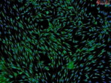 Human Adipose-derived Mesenchymal Stem Cells, Passage 1