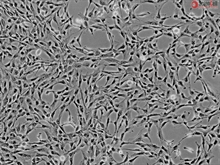 Human Liver-derived Mesenchymal Stem Cells, Passage 1