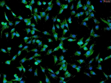 Human Umbilical Mesenchymal Stem Cells, Passage 1