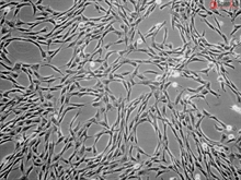 Human Pulmonary Mesenchymal Stem Cells, Passage 1