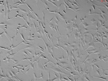 Human Pulmonary Mesenchymal Stem Cells, Passage 1