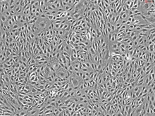 Human Mammary Vascular Endothelial Cells, Passage 1