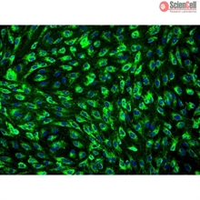 Human Mammary Vascular Endothelial Cells, Passage 1