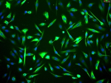 Human Mammary Epithelial Cells, Passage 1