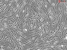 Human Mammary Fibroblasts